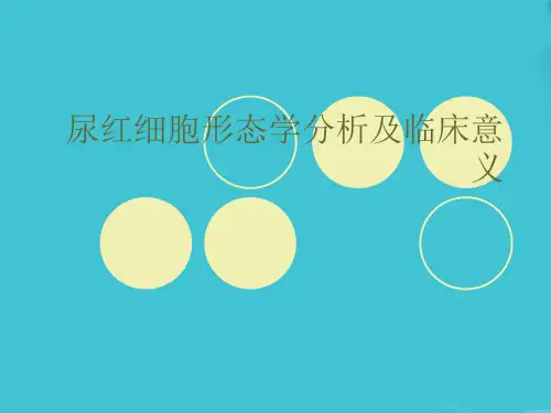 尿红细胞形态学分析及临床意义