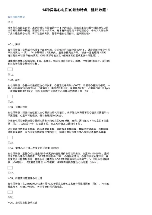 14种异常心电图的波形特点，建议收藏！