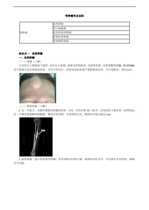 骨肿瘤考点总结