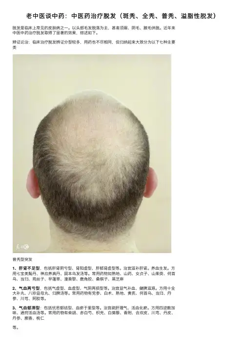 老中医谈中药：中医药治疗脱发（斑秃、全秃、普秃、溢脂性脱发）