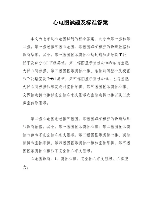 心电图试题及标准答案