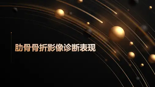 肋骨骨折影像诊断表现