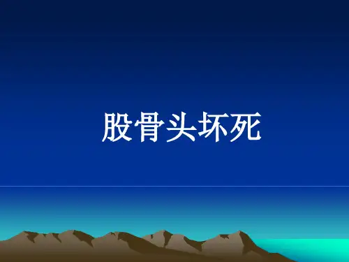 股骨头坏死PPT课件