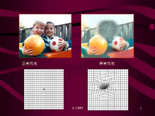 《视网膜及视神经病》PPT课件