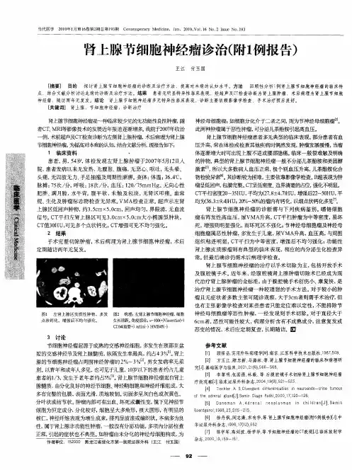 肾上腺节细胞神经瘤诊治(附1例报告)