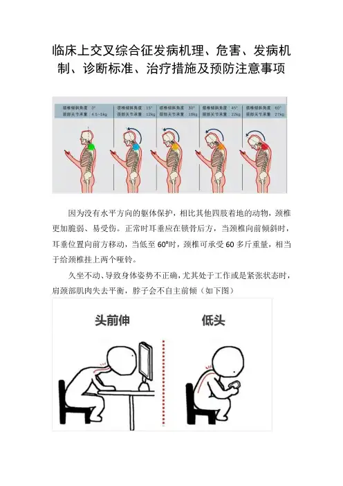 临床上交叉综合征发病机理、危害、发病机制、诊断标准、治疗措施及预防注意事项
