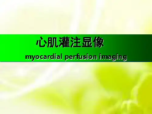 心肌灌注