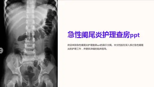 急性阑尾炎护理查房ppt