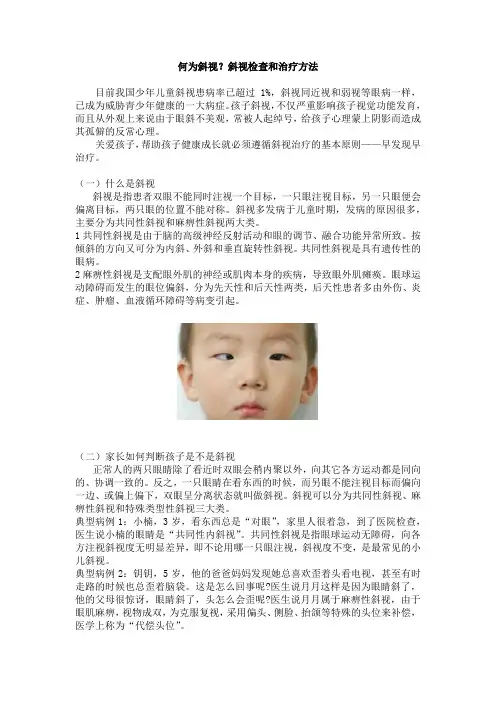 何为斜视何为斜视？斜视检查和治疗方法