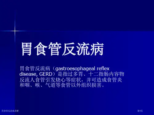 胃食管反流病讲解专家讲座
