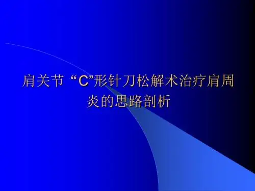 肩关节“C”形针刀松解术治疗肩周炎ppt课件