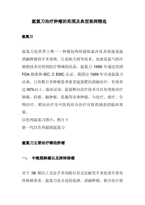 氩氦刀治疗肿瘤的范围及经典案例精选