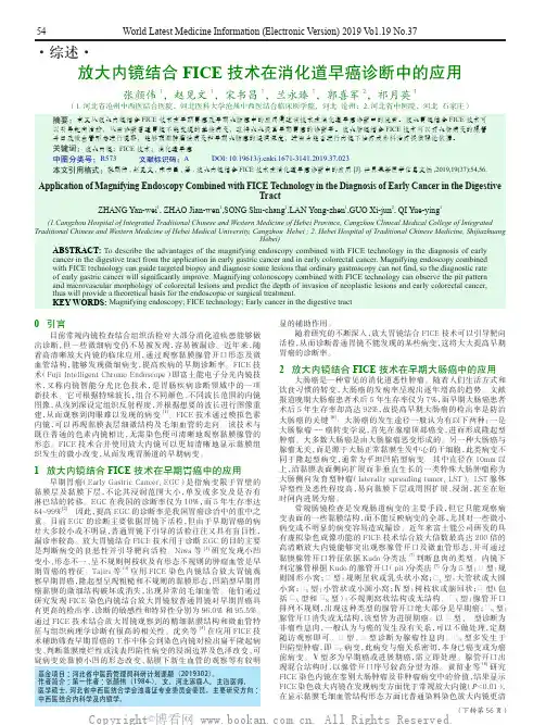 放大内镜结合FICE技术在消化道早癌诊断中的应用