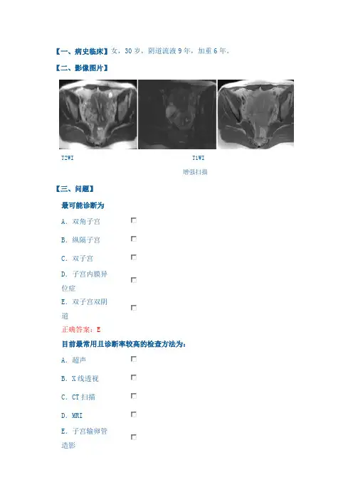生殖系统医学影像病例讨论