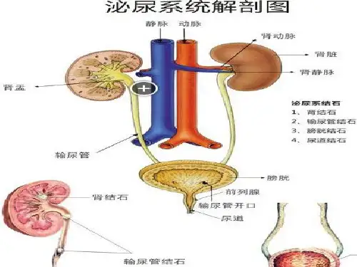 泌尿外科常见疾病的护理ppt课件
