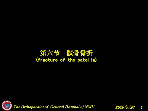 膝关节损伤(韧带、半月板、骨)