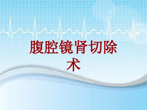 手术讲解模板：腹腔镜肾切除术