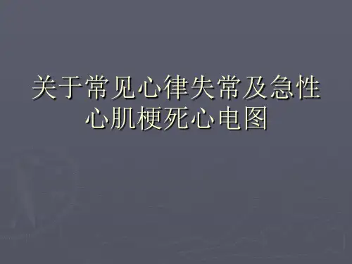 关于常见心律失常及急性心肌梗死心电图课件