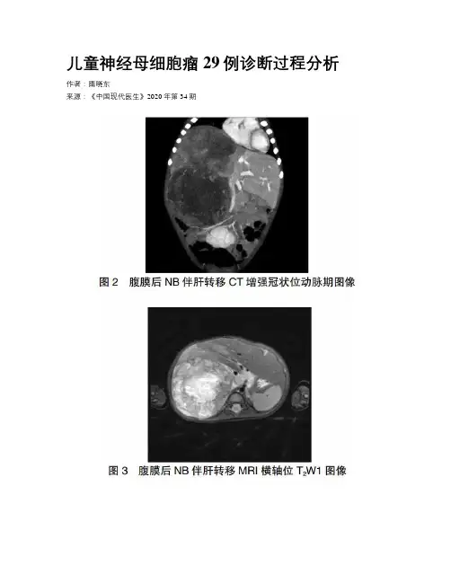 儿童神经母细胞瘤29例诊断过程分析