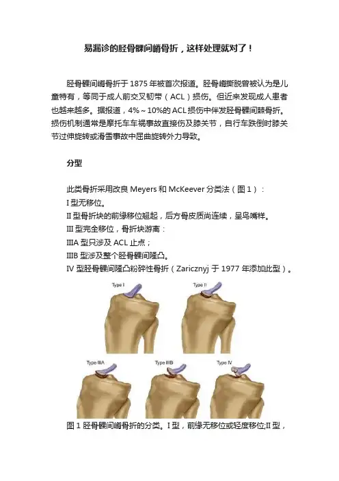 易漏诊的胫骨髁间嵴骨折，这样处理就对了！