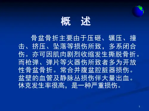 骨盆骨折精选幻灯片课件.ppt