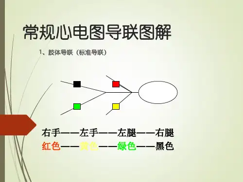 常规心电图图解