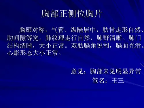 正常正侧位胸片(图19页PPT