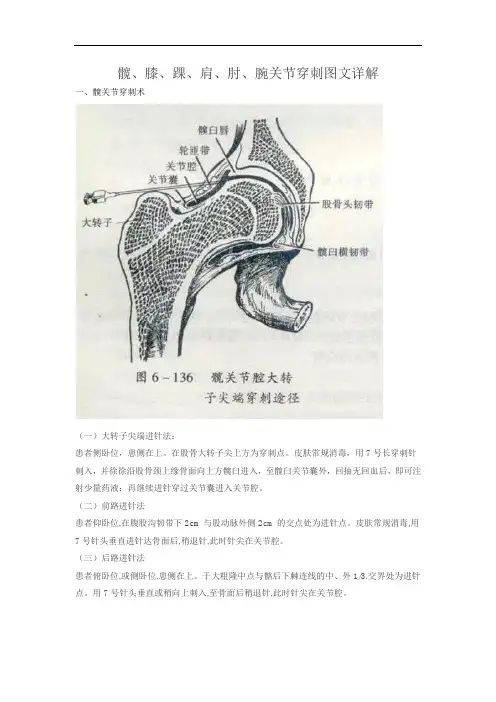 髋、膝、踝、肩、肘、腕关节穿刺图文详细讲解