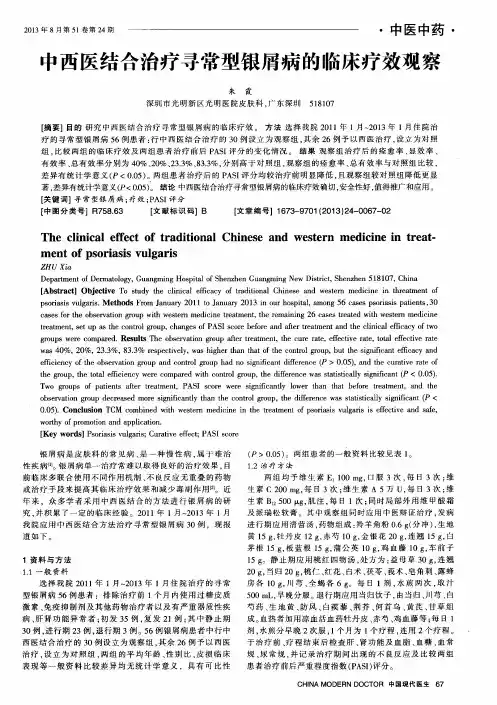 中西医结合治疗寻常型银屑病的临床疗效观察
