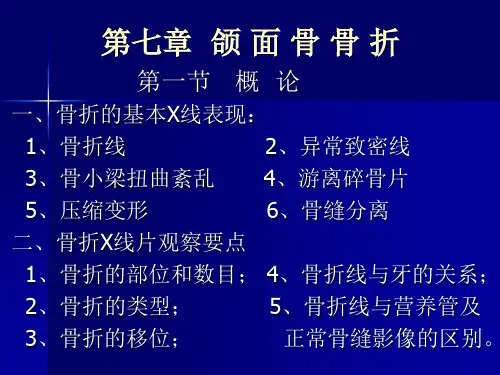 口腔影像学4颌面骨骨折课件