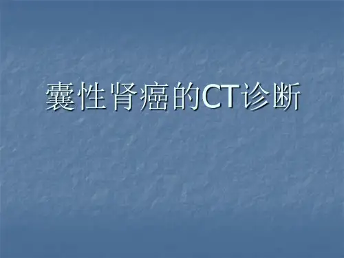 囊性肾癌的CT诊断PPT课件