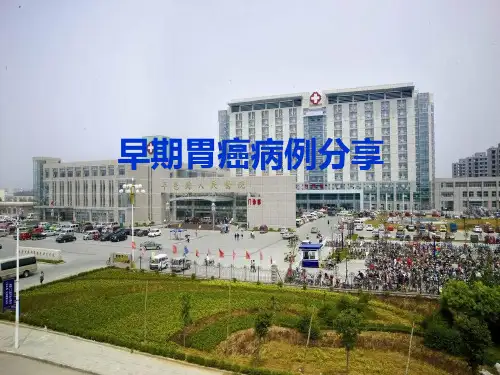 早期胃癌病例分享 ppt课件