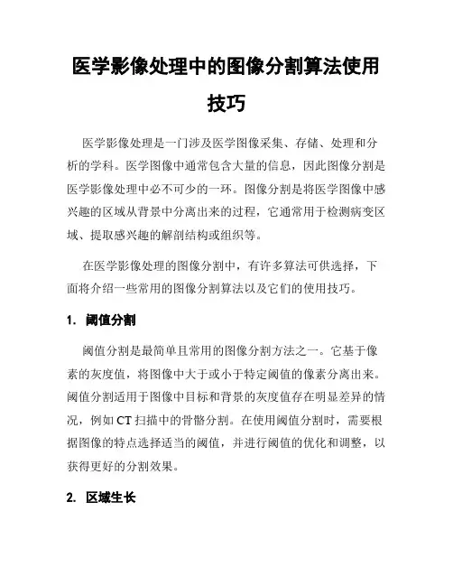 医学影像处理中的图像分割算法使用技巧