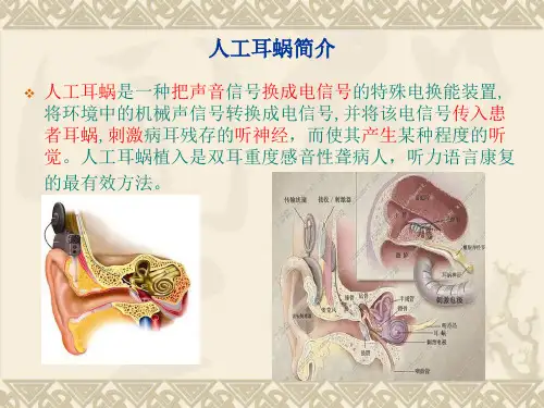 儿童人工耳蜗植入术的简介及麻醉要点-赵献亮ppt课件