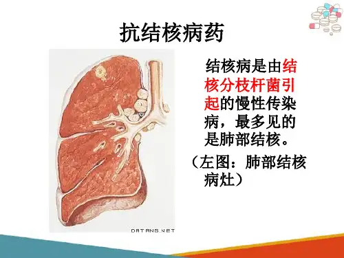 抗结核药—常用抗结核药(药理学课件)