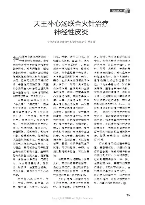 天王补心汤联合火针治疗神经性皮炎