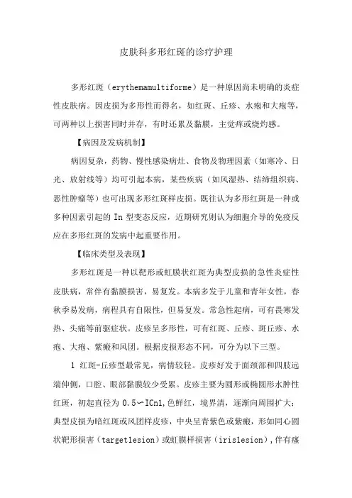 皮肤科多形红斑的诊疗护理