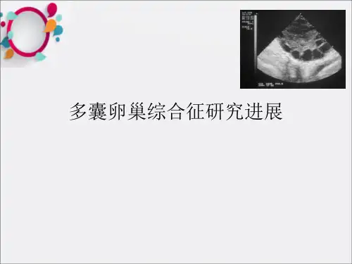 《多囊卵巢综合症》PPT课件