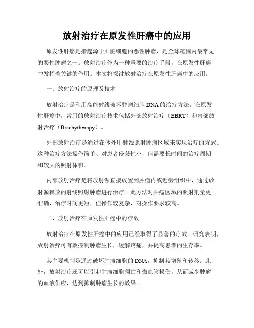 放射治疗在原发性肝癌中的应用