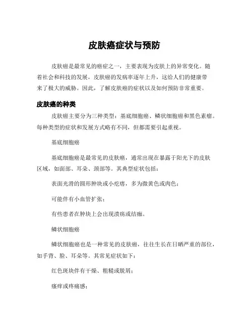 皮肤癌症状与预防