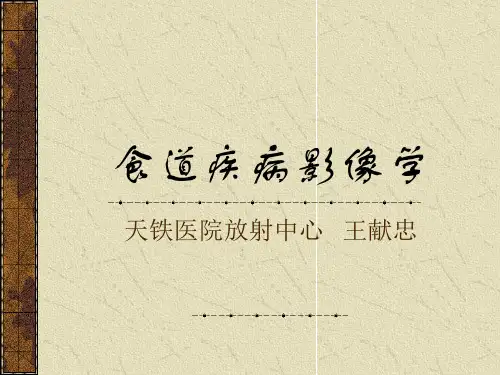 食道解剖