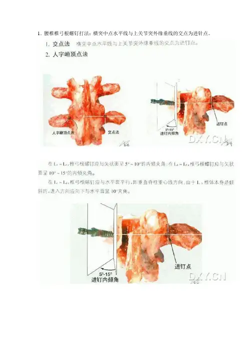 爱爱医资源-椎弓根螺钉进针图文并茂