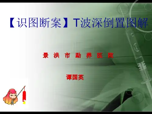 【识图断案】T波深倒置图解