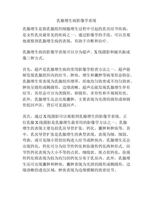 乳腺增生病影像学表现
