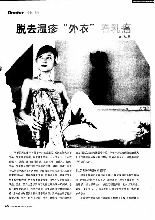 脱去湿疹“外衣”看乳癌