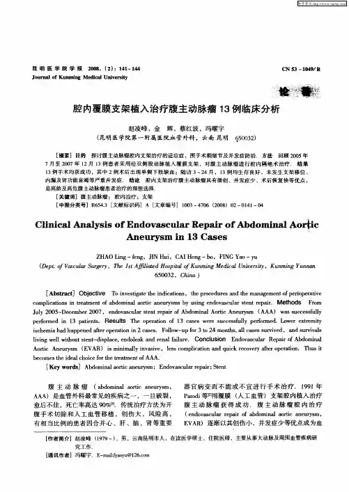 腔内覆膜支架植入治疗腹主动脉瘤13例临床分析