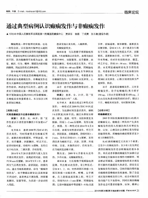 通过典型病例认识癫痫发作与非癫痫发作
