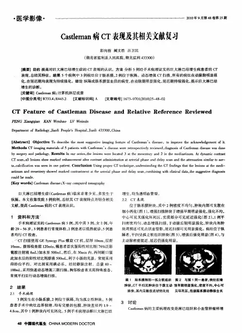 Castleman病CT表现及其相关文献复习
