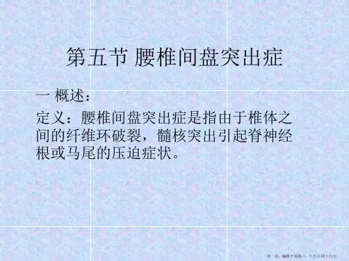 第五节-腰椎间盘突出症