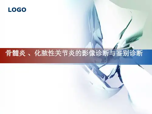 骨髓炎、化脓性关节炎的影像诊断与鉴别诊断